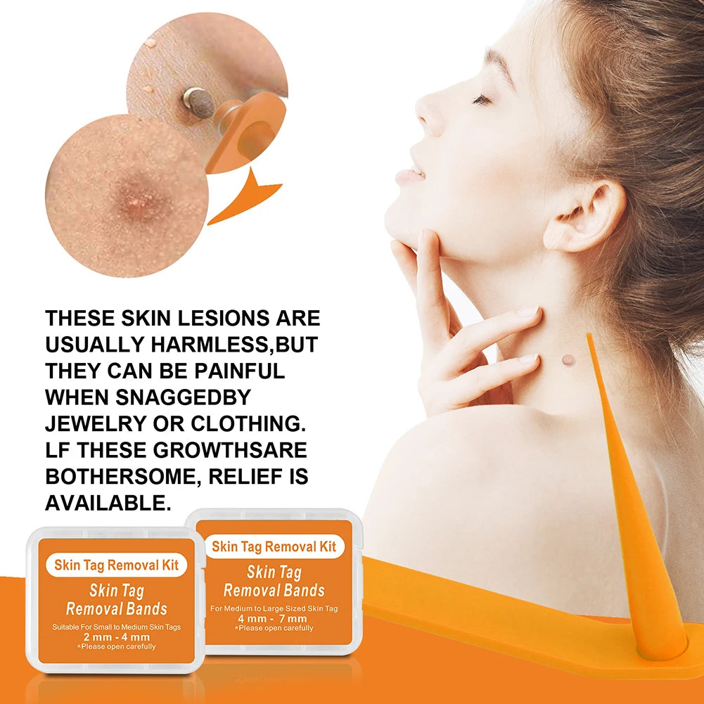 2-in-1 Skin Tag Removal Tool
