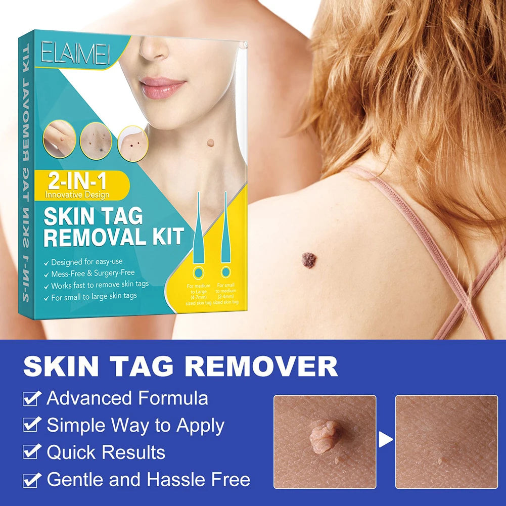 2-in-1 Skin Tag Removal Tool