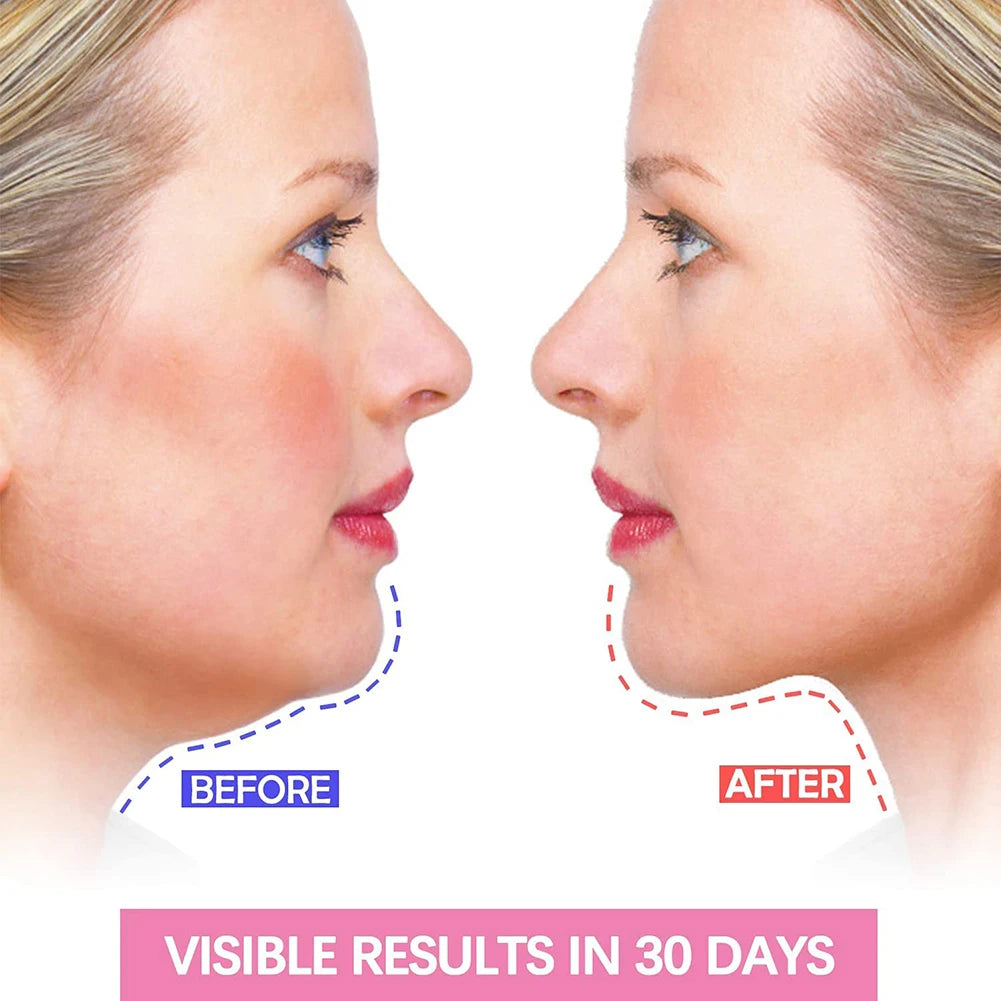 Slimming V-Face Band