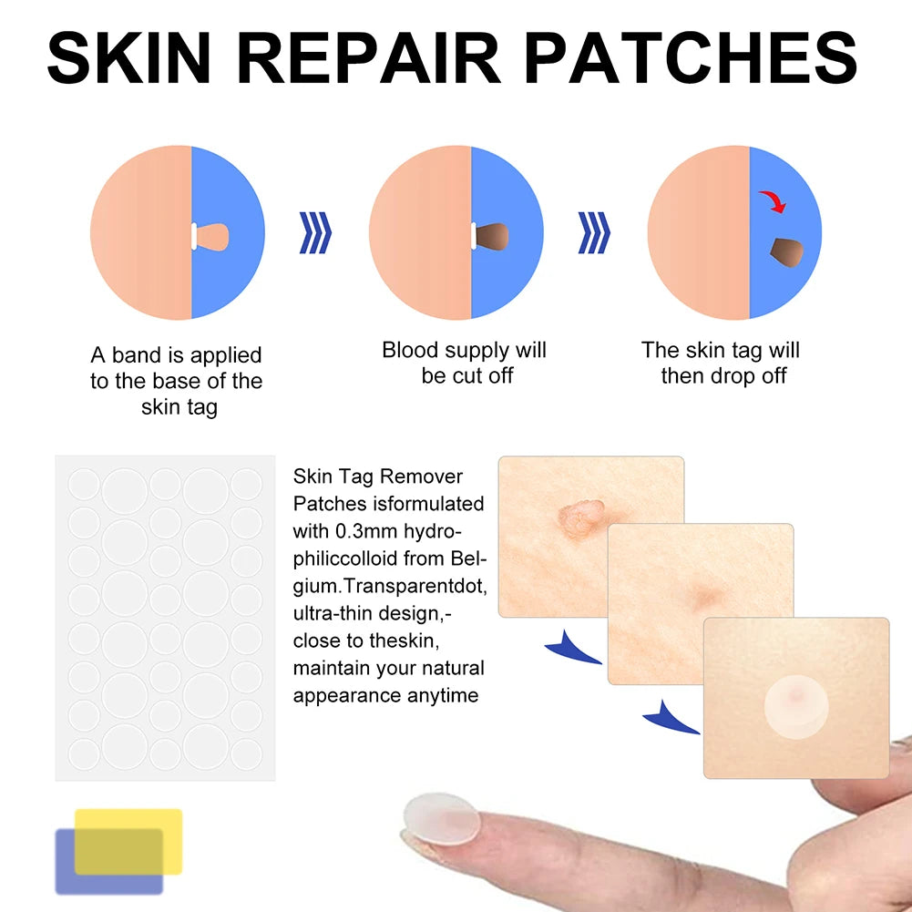 2-in-1 Skin Tag Removal Tool