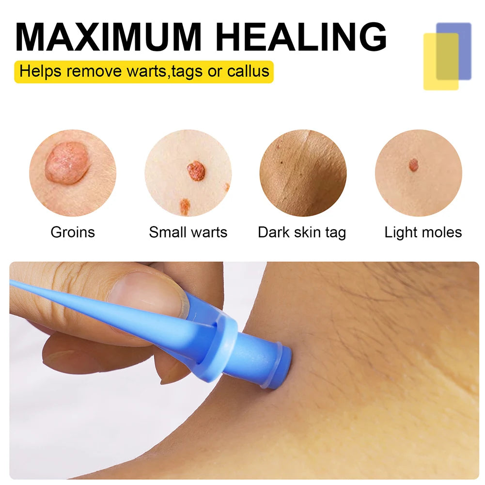 2-in-1 Skin Tag Removal Tool