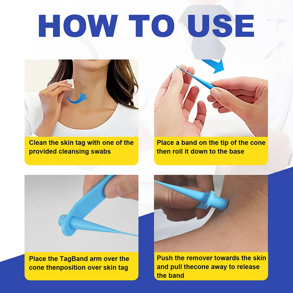 2-in-1 Skin Tag Removal Tool